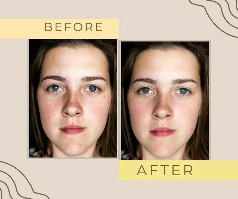 Zafrani Whitening Cream
